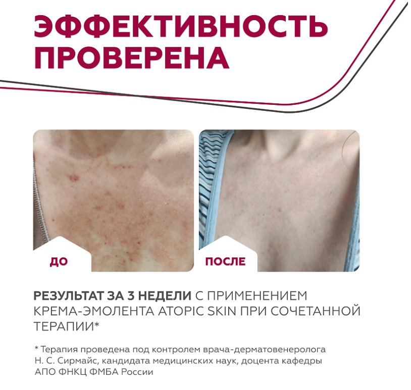 Крем-эмолент для тела Geltek Atopic Skin 240мл - в интернет-магазине tut-beauty.by
