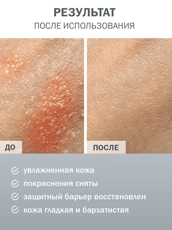 Пенка с пантенолом Фельдшер + алоэ вера 160мл - в интернет-магазине tut-beauty.by